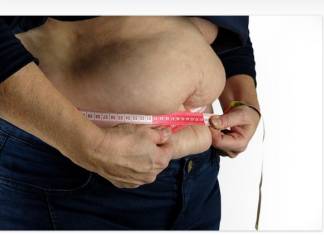 Bariatric Surgery Recommended For Obese Patients with Fatty Liver Problems